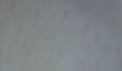 毛細血管のあれこれ｜You-MOST