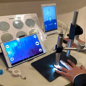 新しい毛細血管カメラ｜You-MOST