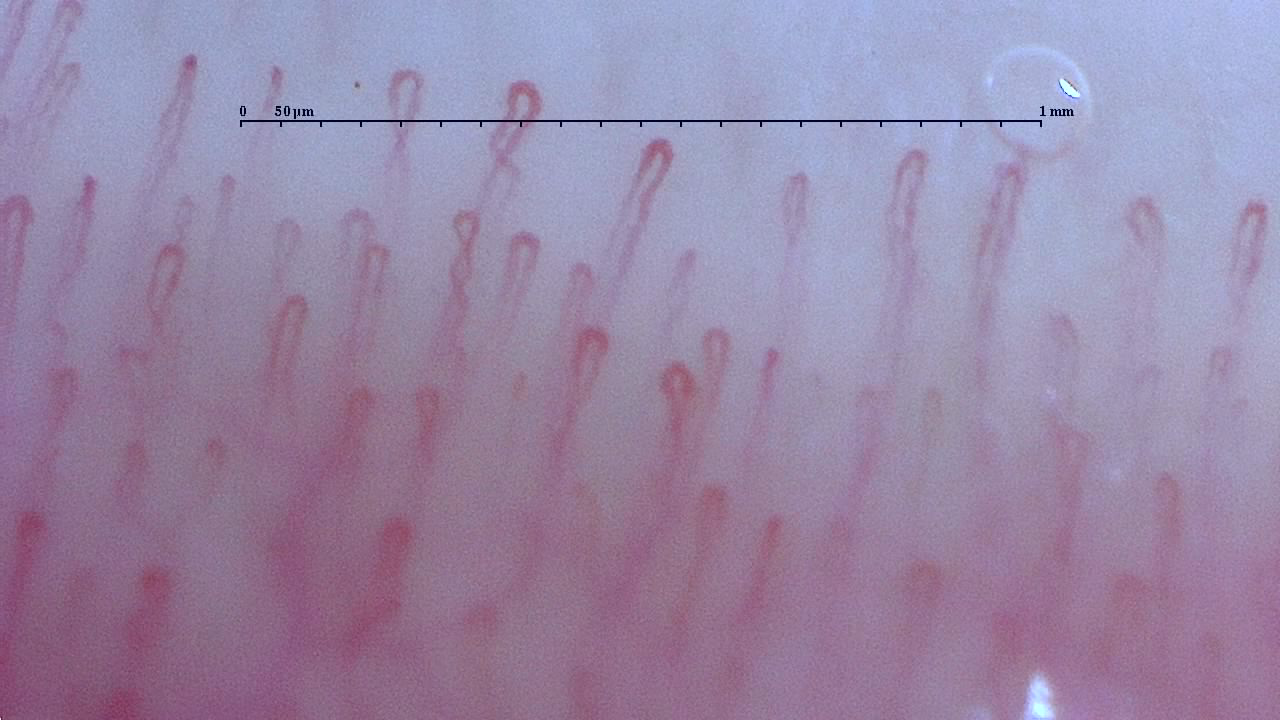 いろいろな毛細血管｜You-MOST