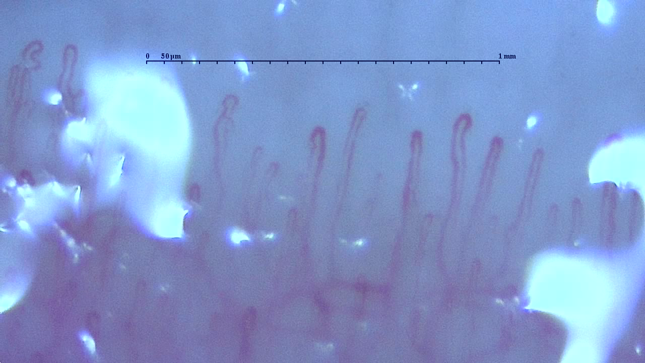 いろいろな毛細血管｜You-MOST