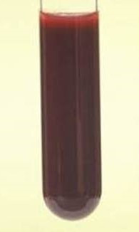 毛細血管の再生｜You-MOST